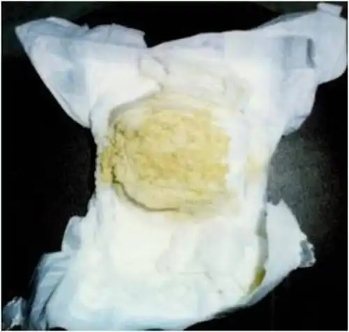 陶土色大便本文是郑珊版权所有,未经授权请勿转载.