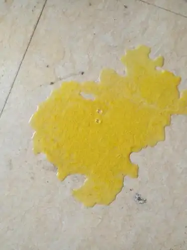 宝宝拉黄色水样大便黏黏的是怎麼一回事