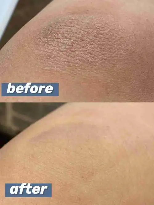 温和去角质,皮肤粗糙有它就够啦