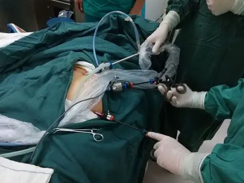 其它 腹腔镜作阑尾不是小题大作(中医院东区外科) 写美篇手术医生:林