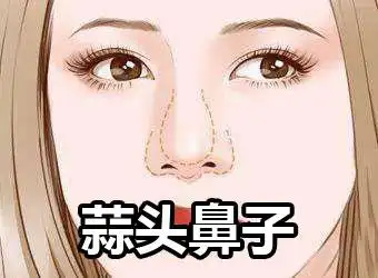 蒜头鼻子的女人的面相怎么解释