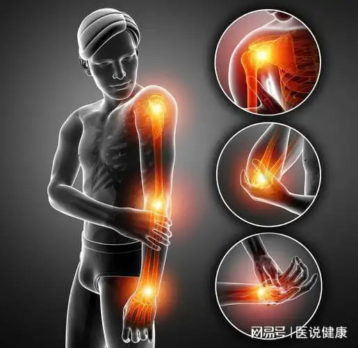 手臂持续疼痛别轻视当心是这4种疾病已找上门需及时检查
