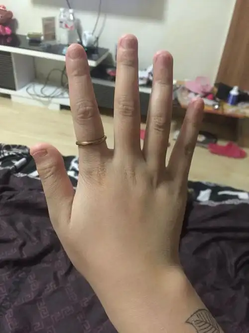 手指甲又宽又短,每家都做不了,我是个女孩很困扰,有没有什么方法能