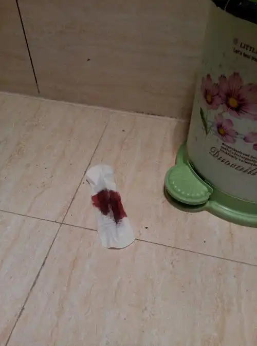 有医生在吗?刚换下来的护垫也有这么多血这正常吗?这第4天