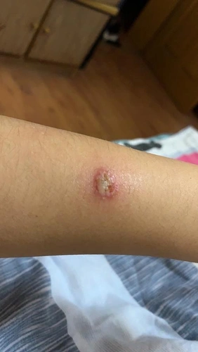 警惕孩子被猫狗传染癣病孩子被传染猫癣怎么办