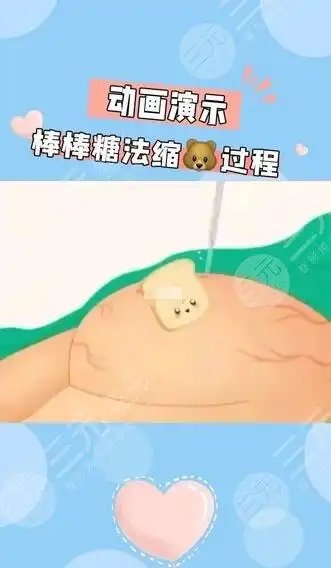 乳房缩小常见方式——附案例对比果图-三元整形网