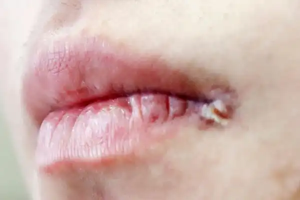 肝脏好不好看嘴唇就能知道?若无这3个表现,证明你的肝脏还不错