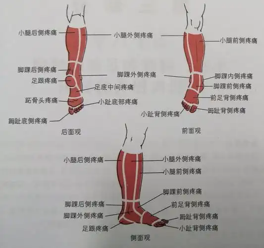 说说小腿,脚踝和足部疼痛的那些事