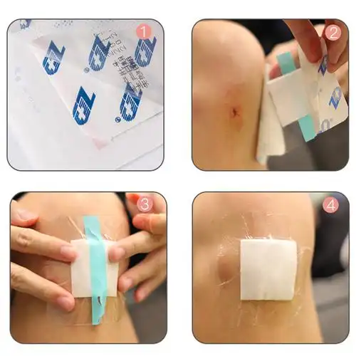 振德透明敷料医用无菌敷料敷贴创可贴伤口敷料洗澡剖腹产防水敷料