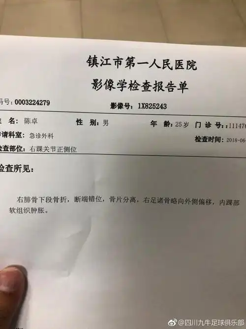 经医院检查,陈卓被确诊为右腓骨下段骨折,断端错位,骨片分离,右足诸骨