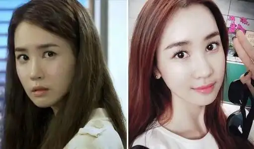 李多海整容前后对比惊人整容失败变蛇精是真的吗