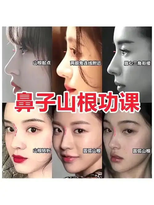 想要好看的鼻子山根功课可不能少避免通天鼻哦