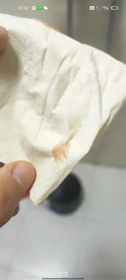 白带酸奶稠浆糊状 一年了 啊啊啊 崩溃