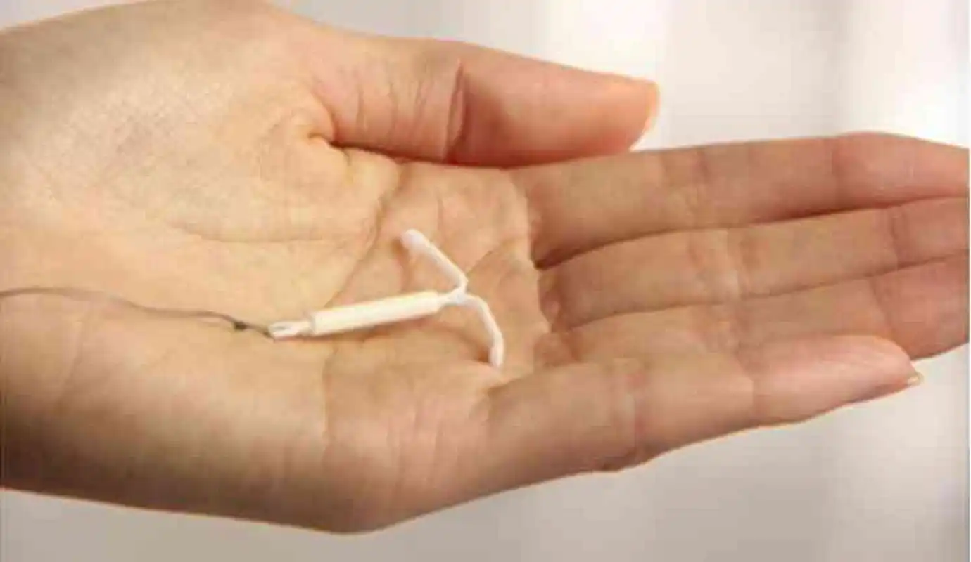 上曼月乐环时需要住院吗?