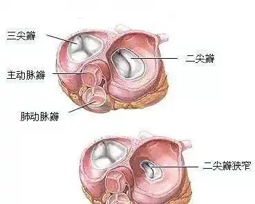 三尖瓣及二尖瓣介绍(图)