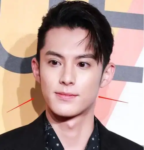 王鹤棣走红前生图曝光,嘴歪大小眼明显,惨被网友吐槽难看