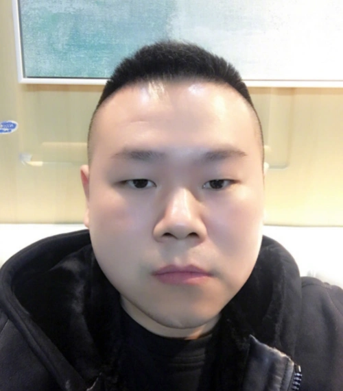 岳云鹏晒自拍称皮肤糙网友怼回去:脑门子都反光了