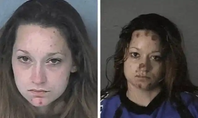 吸笑气吸到大小便失禁,把亲妈鼻梁打断.被毒品彻底毁掉的年轻人