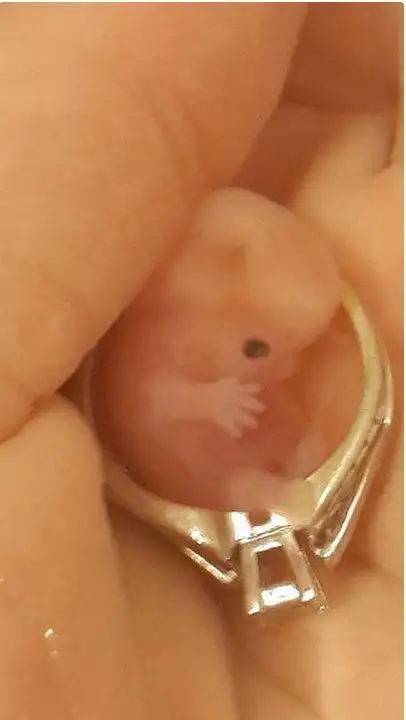 406_720竖版 竖屏