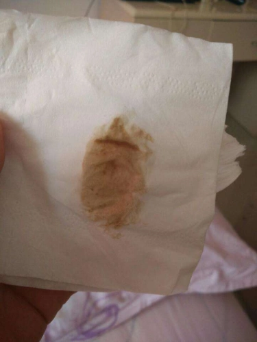 原创"分泌物"成为伤胎凶手,众多孕妇胎停被影响,准妈妈要警惕