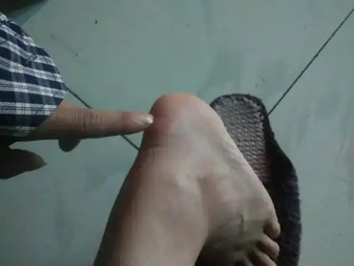 脚后跟蹲下去的时候拉着很痛,站着不痛,站着按也不通,是什么原因,有一