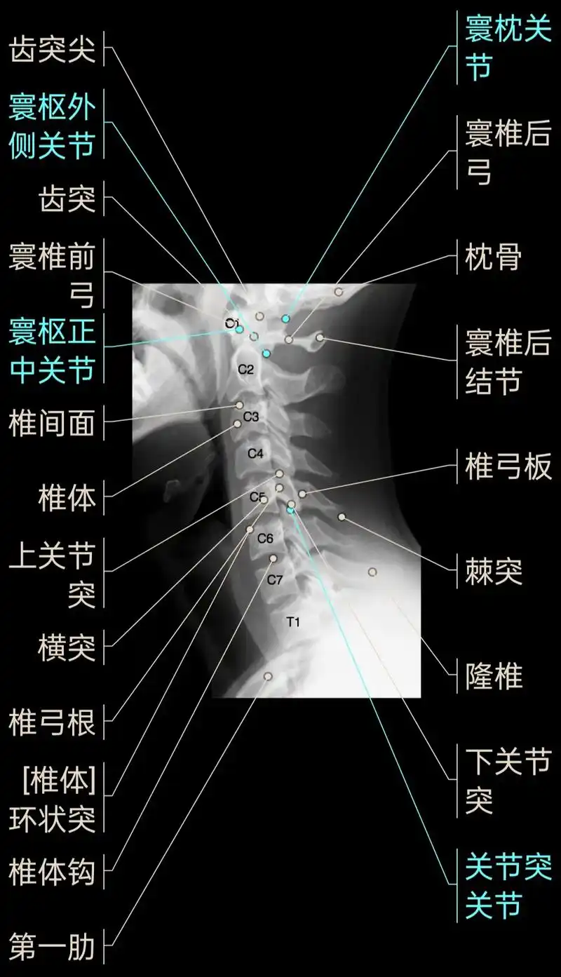 颈椎前倾后屈位,正斜位x线图解.#颈椎 #放射科 #医学影像 - 抖音