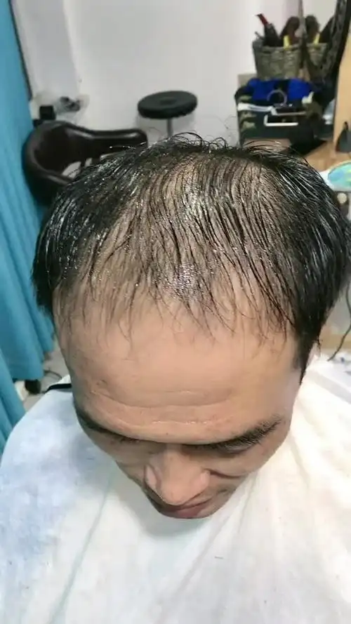 适合秃顶男人的发型来了不会再让你拥有秃顶的尴尬