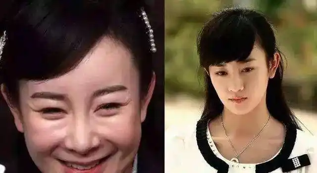 原创这几位女明星曾经都是美女如今却整容失败她像老了十岁