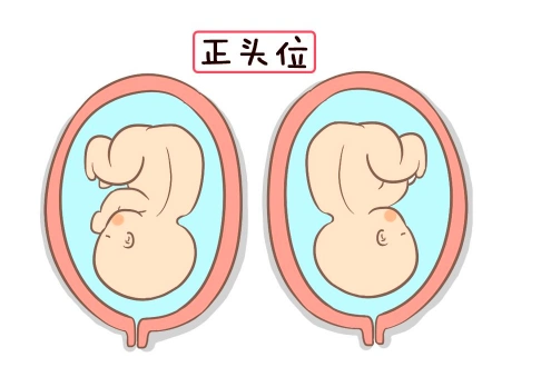 胎儿出生时姿势非常重要,它直接决定胎儿出生后的健康状态.