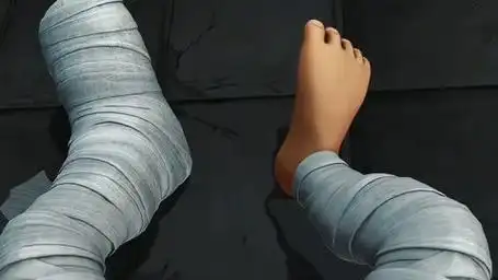 受伤的光头强浑身缠满了绷带 #熊大熊二光头强 #熊出没 #小熊熊