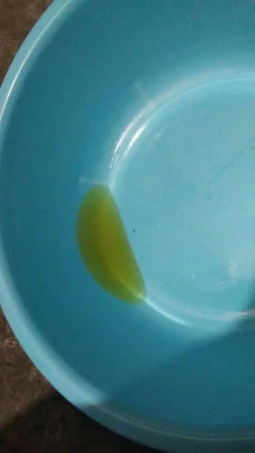 为什么就尿一点,颜色特别黄,怎么回事?