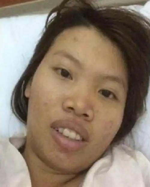 越南丑女相亲屡次被拒,花钱整容后判若两人,从此人生大逆转!