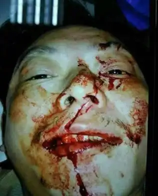 打架被砍伤流血图片