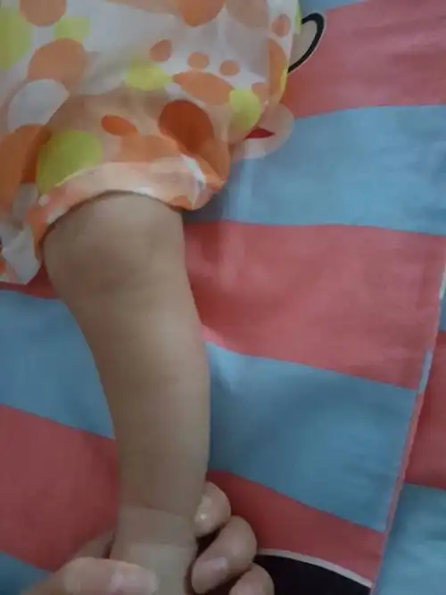 腿型,四月份的宝妈们,你们的宝宝腿型都什么样了,我_妈妈网轻聊_千万