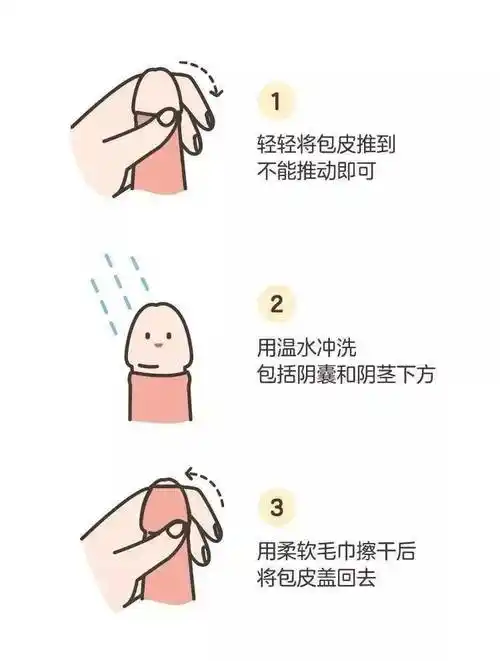 宝宝私处的异常情况千万别大意男宝宝有3种女宝宝有6种