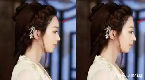 侧脸很丑是什么原因?