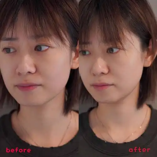 那些年美妆博主发的beforeafter对比图