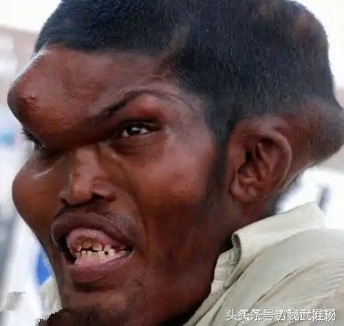 盘点全球最丑的男人