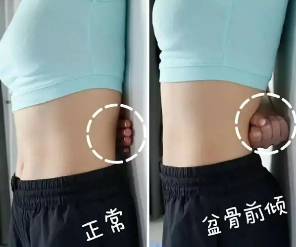 具体表现为腰部用力,向后翘臀,肚子往前凸.