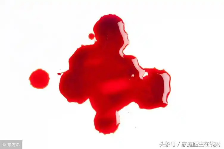 1,呕血当患者呕吐物的颜色呈鲜红色或者暗红色时,一般是上消化道出血