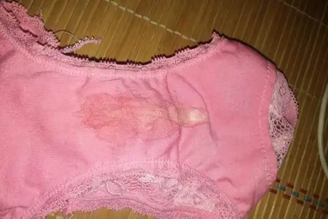 内裤上的黄色物里面住着多少病菌说出来估计没人会相信