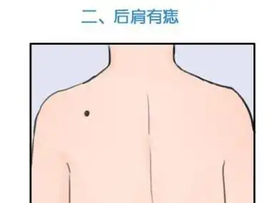 背后有痣的女人命运 背后痣有什么含义