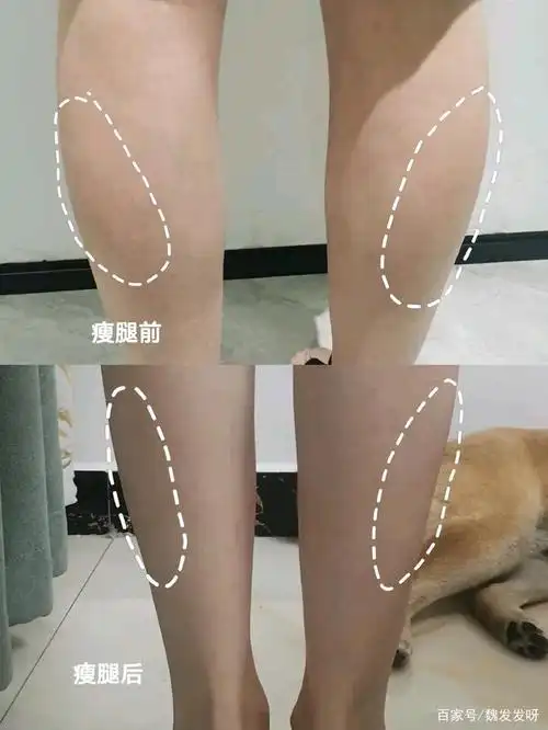 27岁女生,小腿肌肉较发达,脂肪含量正常.身高160cm,体重100斤.