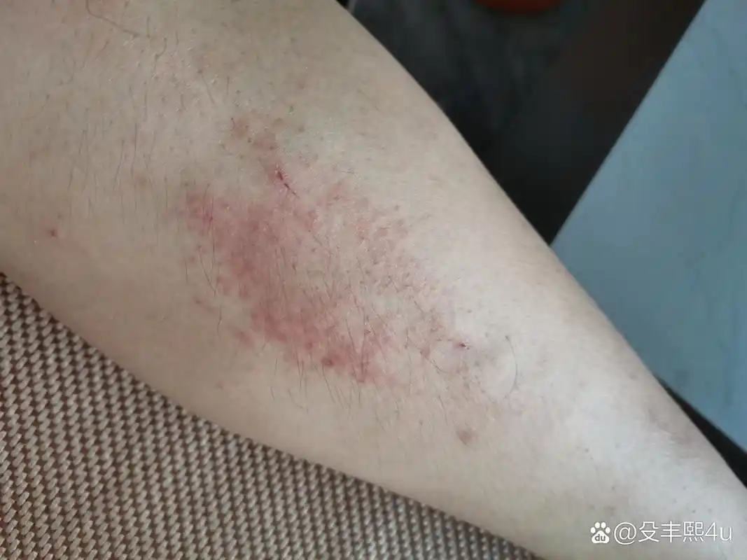 小腿上不知道起的什么小.