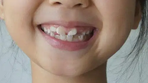 来自奥新全民儿牙中心 - 微博