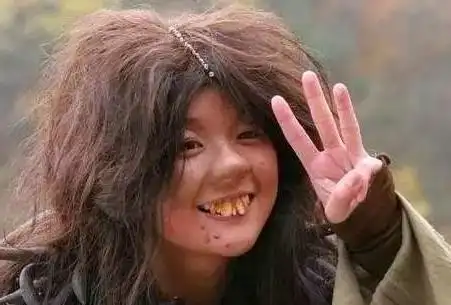 《功夫》里的"龅牙珍",人如其名有着一口大龅牙.