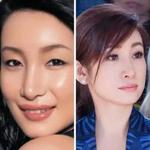 明星整容前后大对比,谁割没割双眼皮,一看便知