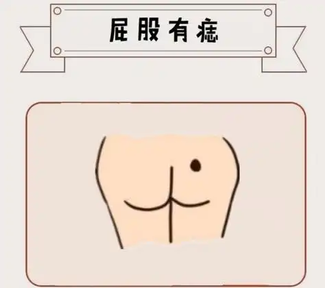 孩子屁股上有痣风水上好吗 女人左屁股上长痣好不好-万年历网