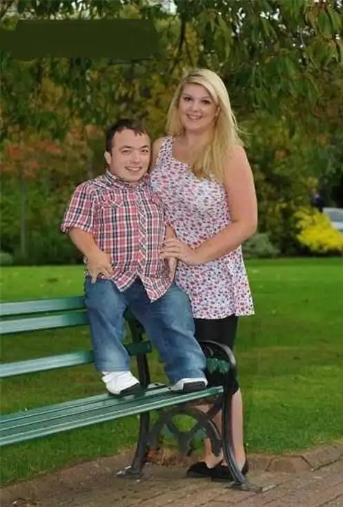 侏儒症爸爸身高11米妈妈身高17米他们的孩子会有多高