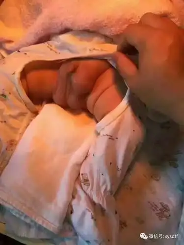 23天的宝宝得了疝气,感恩名医名方!